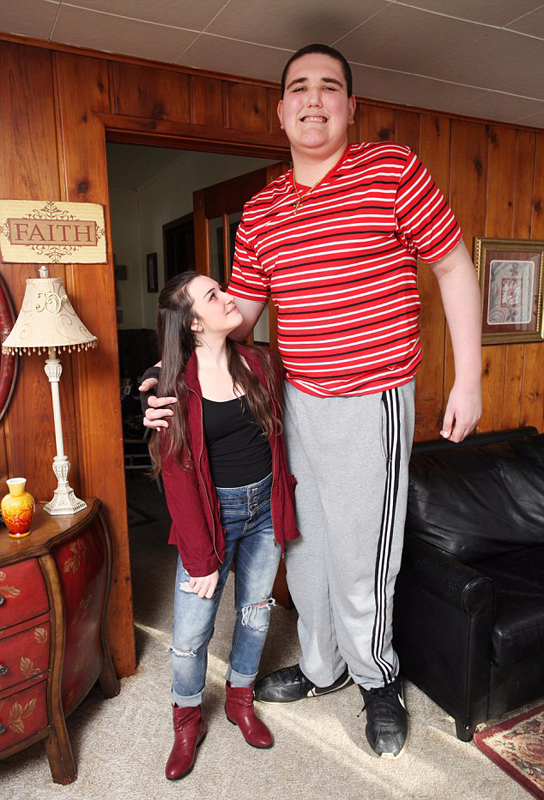 美19岁青年患罕见巨人症 身高近2米35