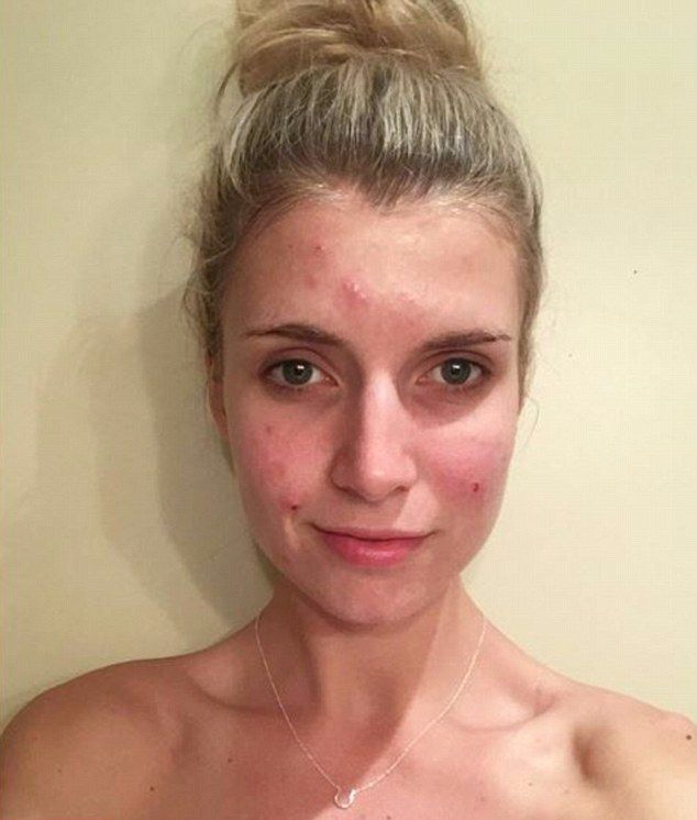 网红分享素颜照:不想其他女孩因我自卑