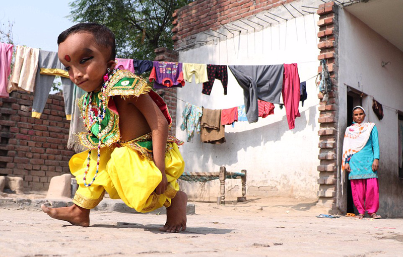 印度6岁男童长大头细长眼被奉为神灵